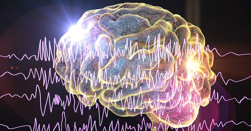 Bệnh động kinh xảy ra khi luồng sóng điện chạy qua não có đặc điểm bất thường