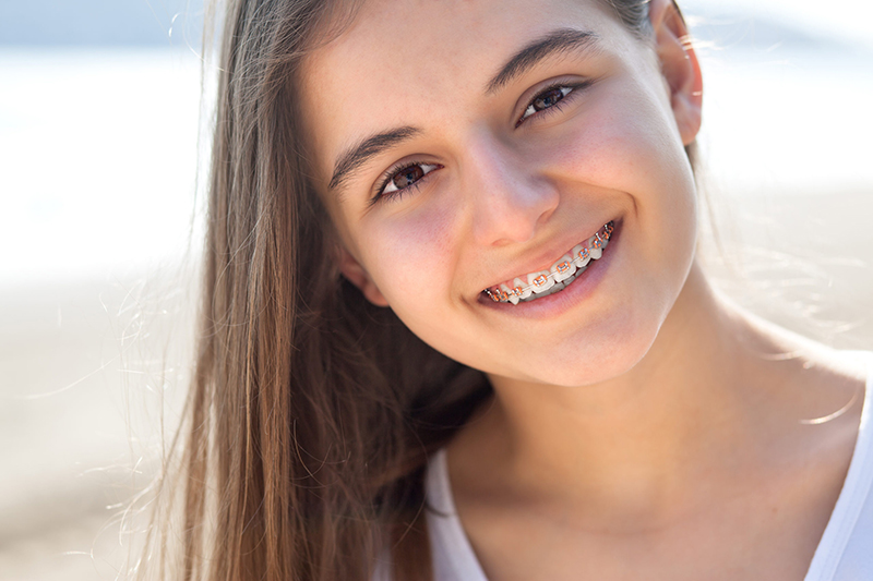Khi nào nên niềng răng, theo lời khuyên của các chuyên gia bạn nên thực hiện niềng răng vào giai đoạn 6 - 12 tuổi để mang lại hiệu quả tốt