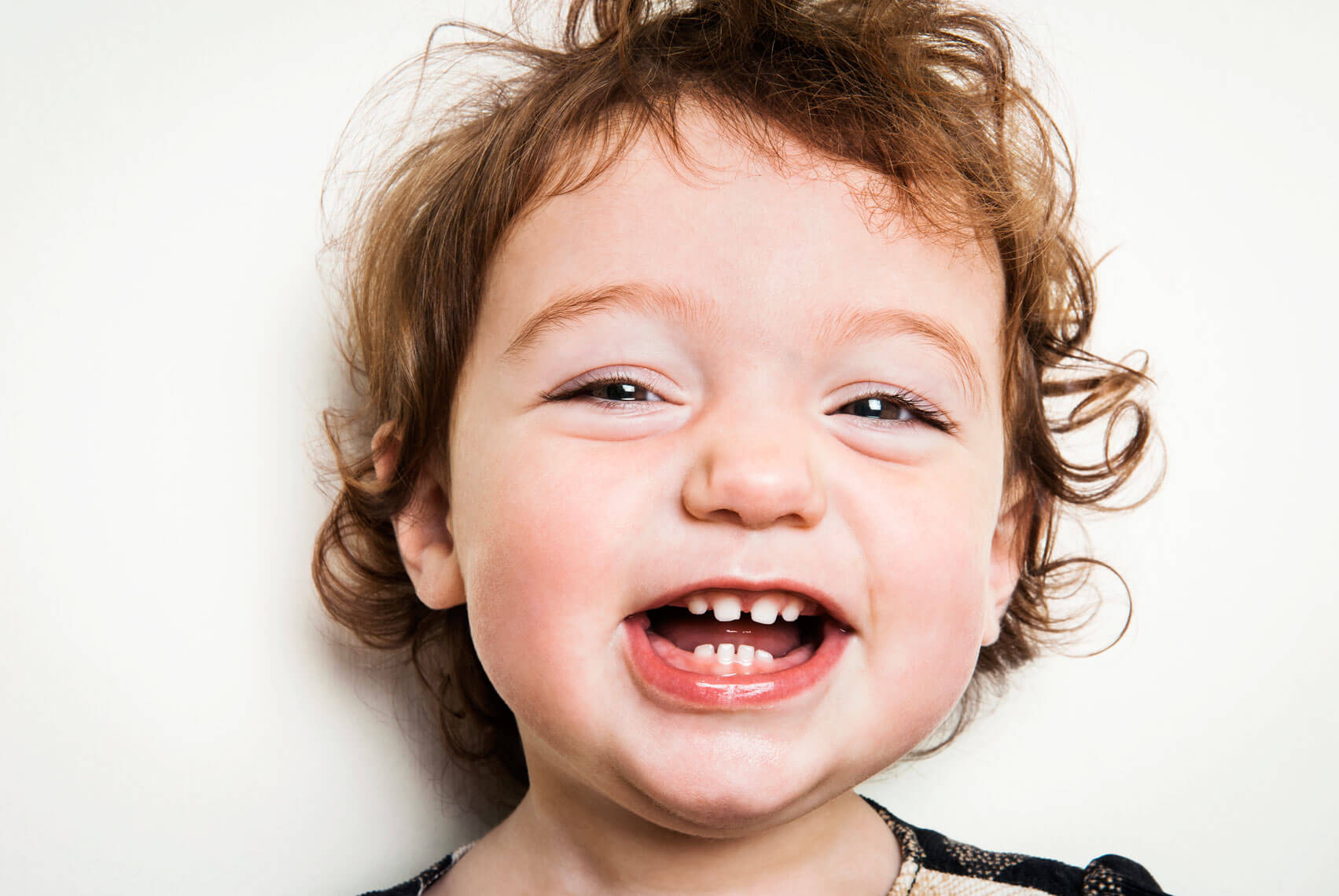  Răng trẻ bị mòn dễ dẫn tới sâu răng