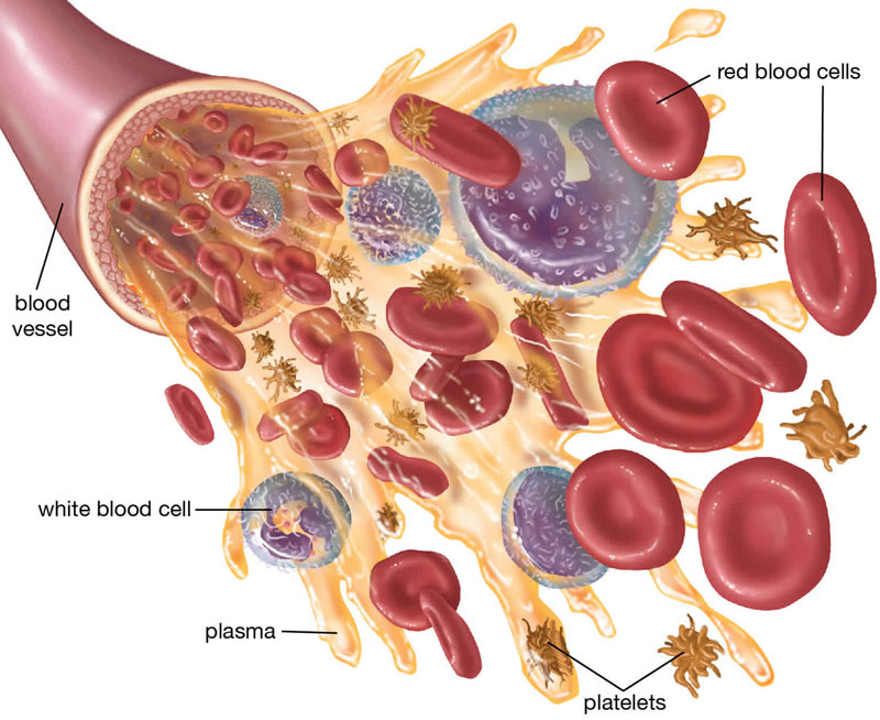 Sốc xuất huyết là biến chứng thường gặp của bệnh nhân viêm tụy