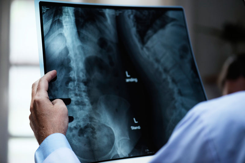 Chụp X - quang đường tiêu hóa giúp việc chẩn đoán trở nên dễ dàng hơn