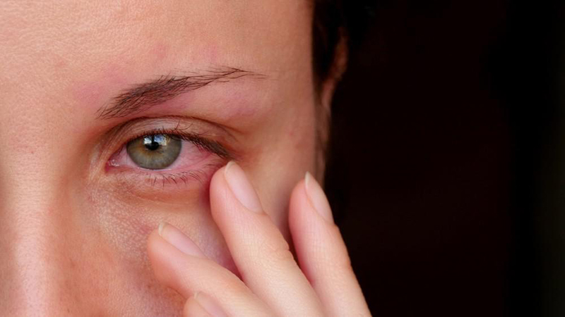 Các loại nấm sau khi đã xâm nhập được vào mắt sẽ phát sinh ra độc tố 