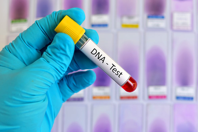 Số lượng hay nồng độ virus sẽ được đánh giá thông qua xét nghiệm HBV - DNA