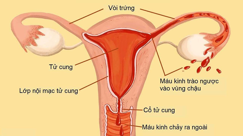 Nội mạc tử cung là lớp niêm mạc lỏng, xốp ở bên trong tử cung