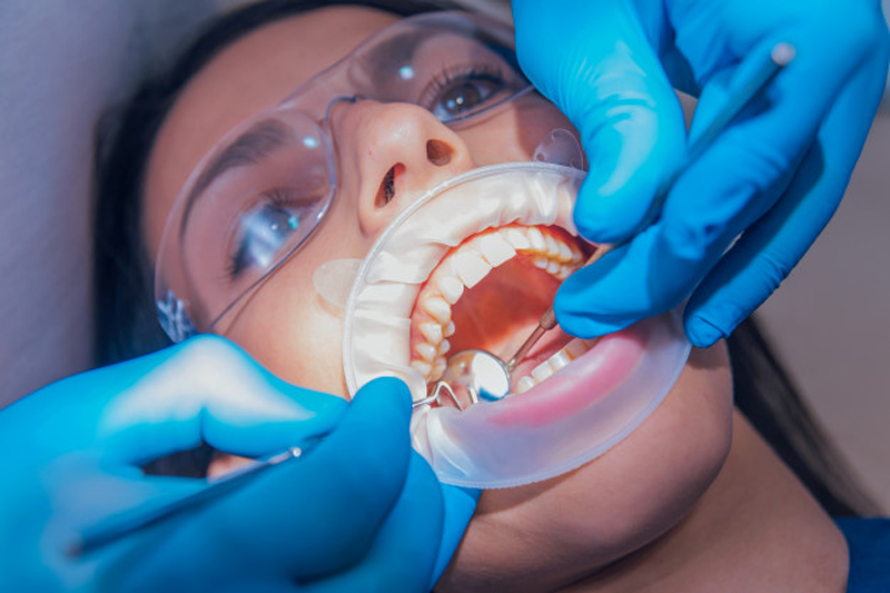 Điều trị tủy răng càng được thực hiện sớm thì càng ít gây biến chứng 