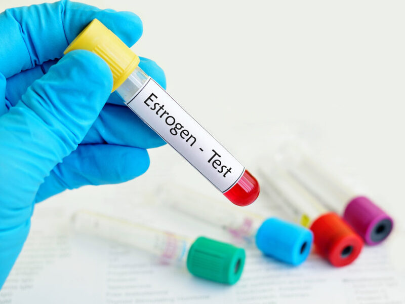  Xét nghiệm hormone Estrogen đánh giá sức khỏe sinh sản ở nữ