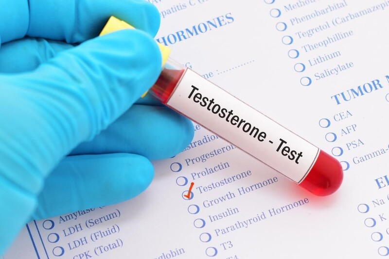  Nam giới thường xét nghiệm hormone Testosterone