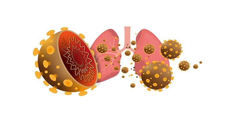 COVID-19 là căn bệnh viêm đường hô hấp cấp nguy hiểm, có tốc độ lây nhiễm khủng khiếp