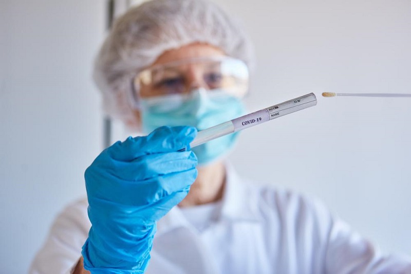 Xét nghiệm PCR được xem như là tiêu chuẩn đánh giá nhiễm virus nên quy trình nghiêm ngặt hơn