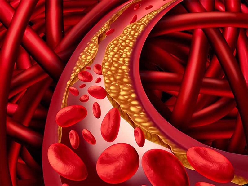 Các renins gắn acid mật có thể làm giảm đáng kể lượng LDL-C trong máu