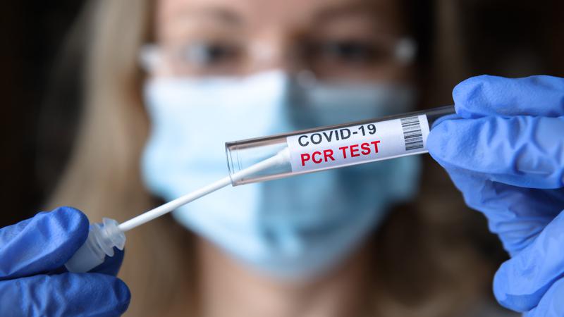   Xét nghiệm RT-PCR có thể đánh giá chính xác sự tồn tại của virus trong cơ thể