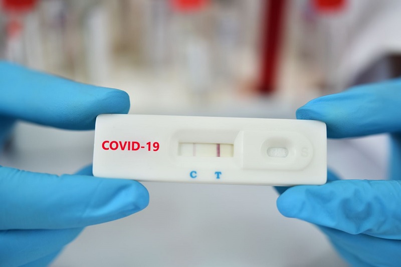  Test nhanh Covid được áp dụng rộng rãi trong cộng đồng để sàng lọc ca nhiễm