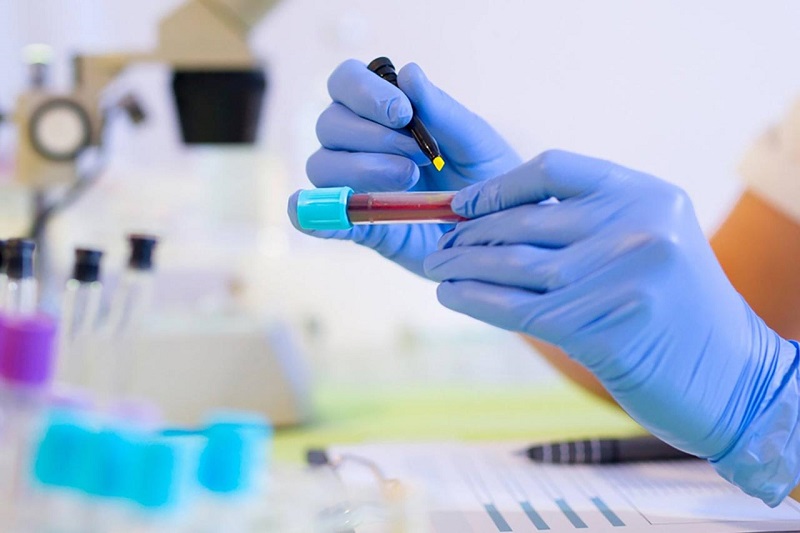 Xét nghiệm kháng thể trong máu để đánh giá khả năng đáp ứng miễn dịch 