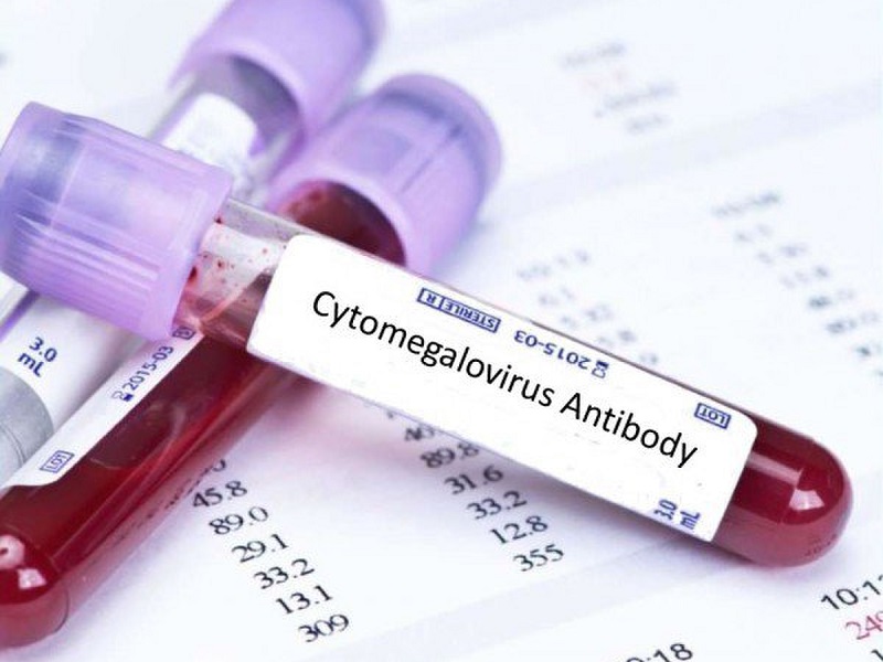 Xét nghiệm máu giúp tìm ra virus Cytomegalo