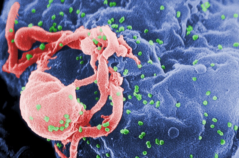 Human Immunodeficiency virus - tác nhân gây ra bệnh HIV