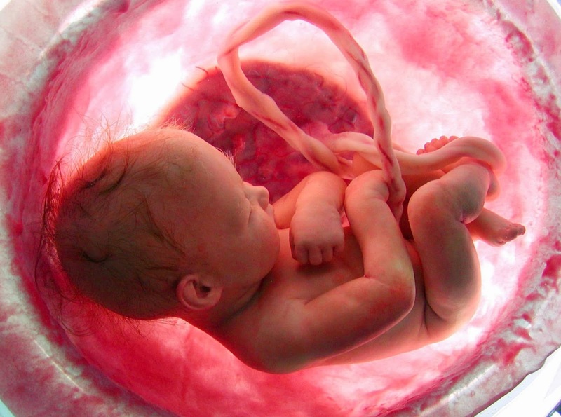  Dị tật thai nhi do bất thường gen rất nghiêm trọng