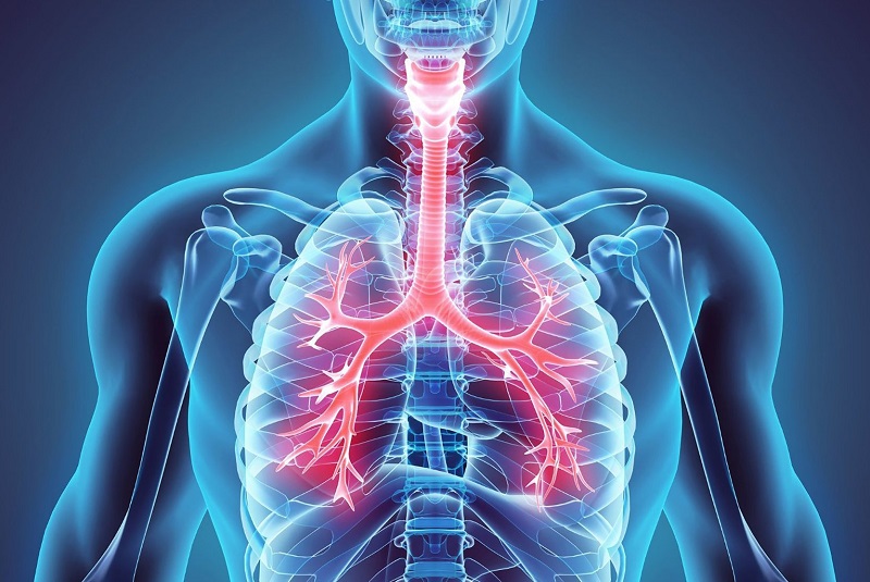 Đường ống dẫn khí đến phổi bị viêm dẫn đến các cơ co thắt phế quản 
