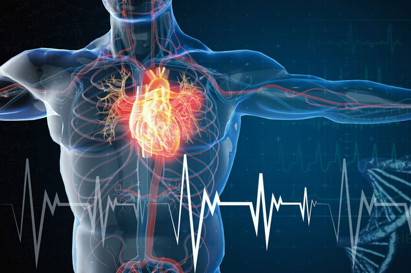 Nhồi máu cơ tim dẫn đến tử vong hàng đầu