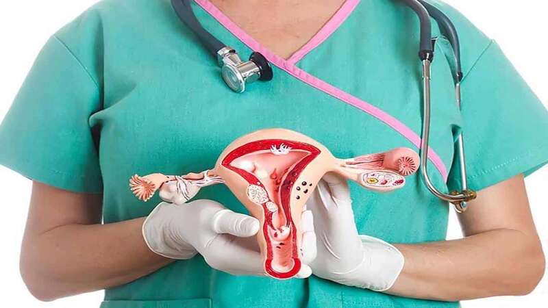 Polyp nội mạc tử cung có thể là hậu quả của nạo phá thai không an toàn
