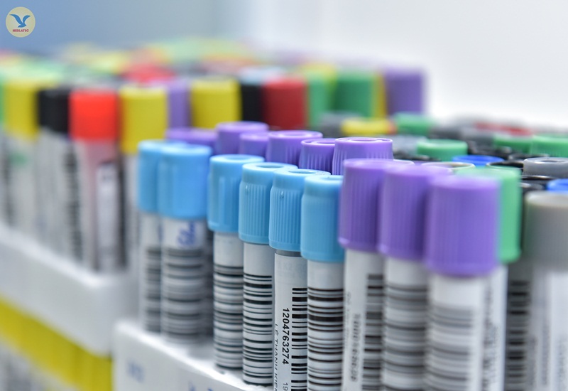 Xét nghiệm máu là xét nghiệm cơ bản giúp phát hiện nhiều loại bệnh lý