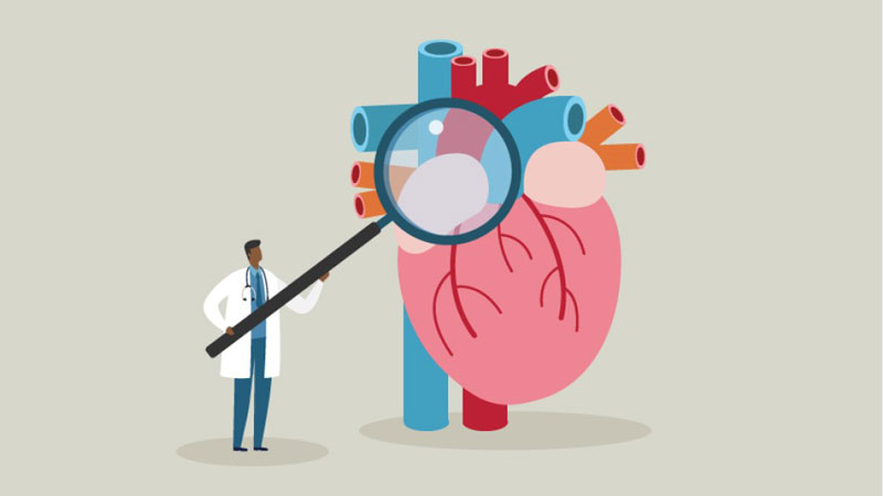 Thiếu máu cơ tim là vấn đề tim mạch thường gặp