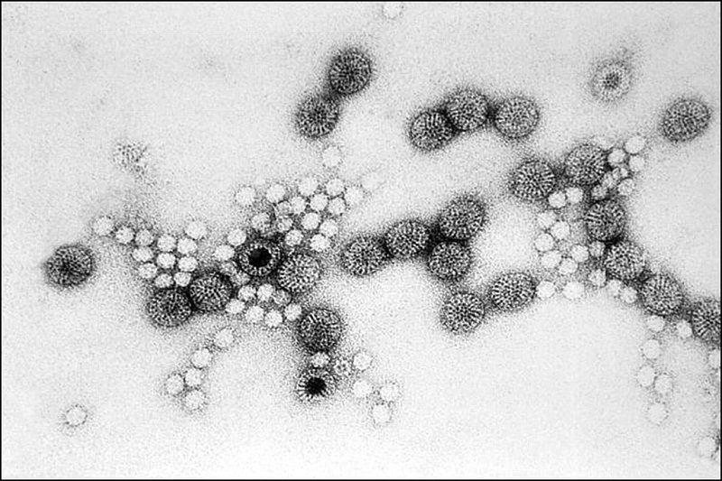 Virus Rota - tác nhân gây bệnh tiêu chảy cấp nguy hiểm ở trẻ em