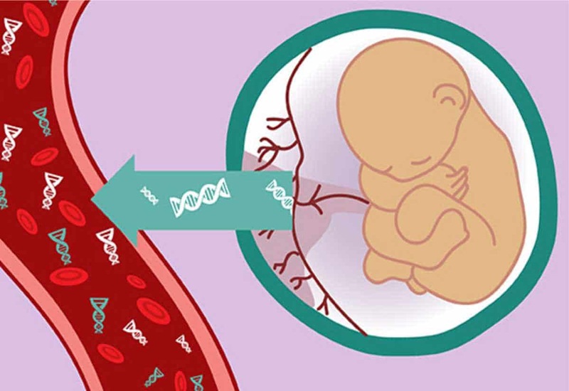 Xét nghiệm ADN trước sinh không xâm lấn an toàn với thai nhi và mẹ bầu