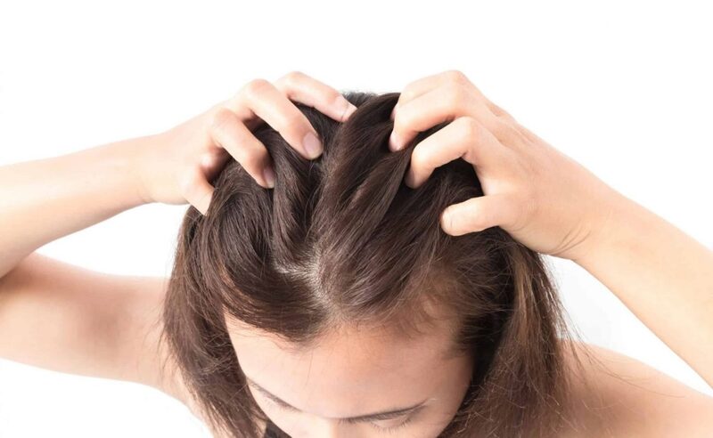 Rụng tóc nhiều là tình trạng khá thường gặp ở phụ nữ sau sinh