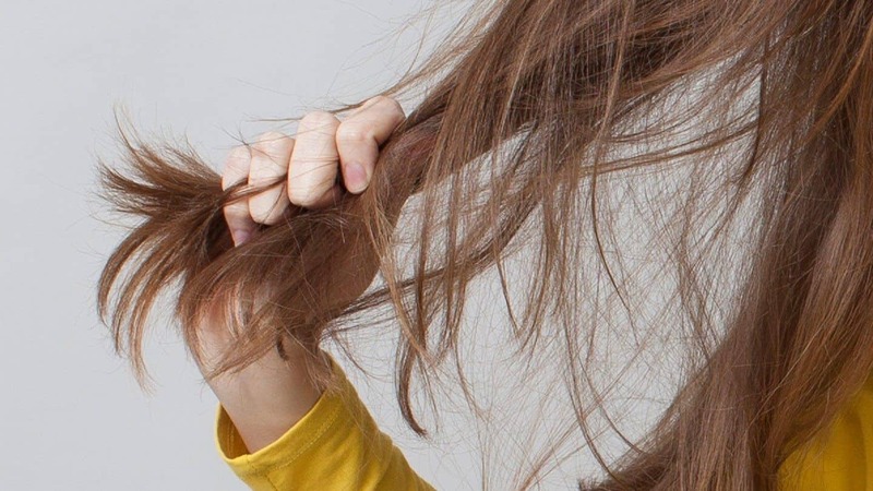  Rụng tóc nhiều sau sinh chủ yếu do sụt giảm estrogen