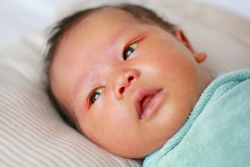 Trẻ sơ sinh vàng mắt là nỗi lo lắng của nhiều cha mẹ 