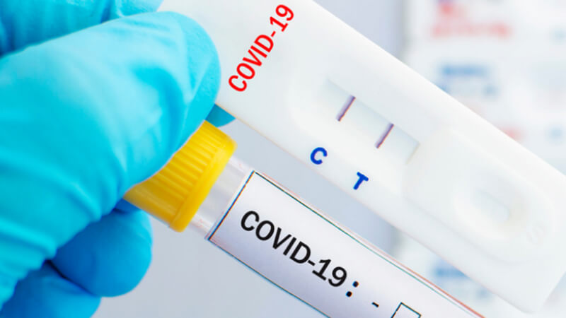 Xét nghiệm sàng lọc Covid nhằm đánh giá sự tồn tại của virus SARS-CoV-2 trong cơ thể