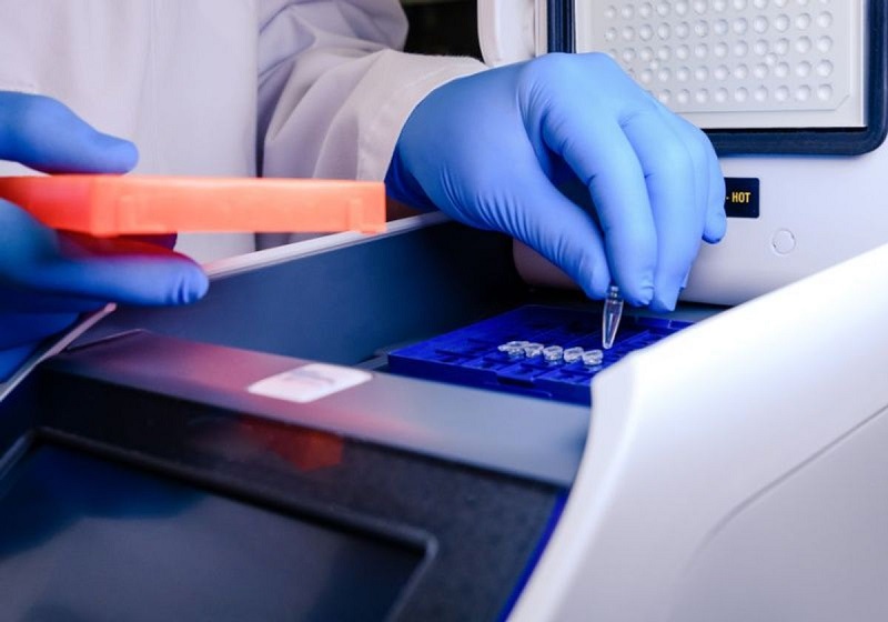 PCR đòi hỏi trang thiết bị hiện đại và yêu cầu kỹ thuật cao