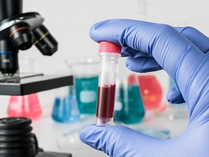 Xét nghiệm tổng phân tích tế bào máu giúp bác sĩ có cơ sở chẩn đoán thiếu máu