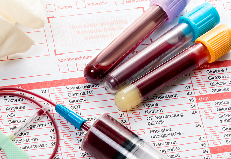 Bạn có thể ăn uống bình thường trước khi làm các xét nghiệm máu