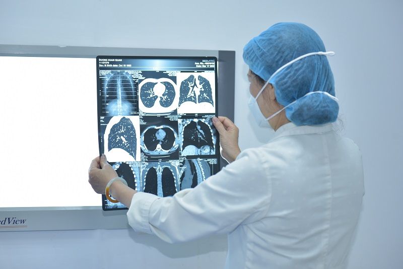 Dựa vào ảnh chụp cắt lớp vi tính các bác sĩ có thể chẩn đoán chính xác tình trạng bệnh