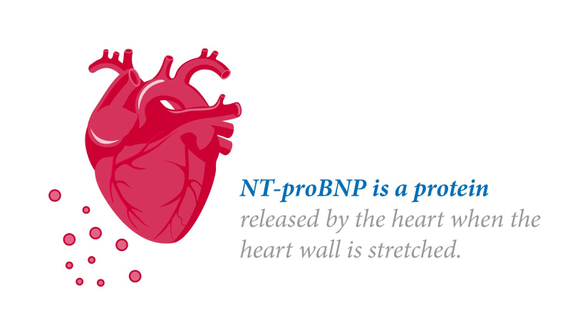 NT-proBNP là một protein do tế bào cơ tim giải phóng vào máu khi buồng tim bị giãn