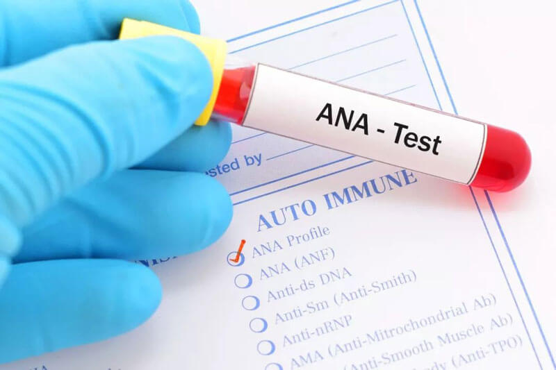 Xét nghiệm ANA được dùng để chẩn đoán nhiều loại bệnh lý tự miễn