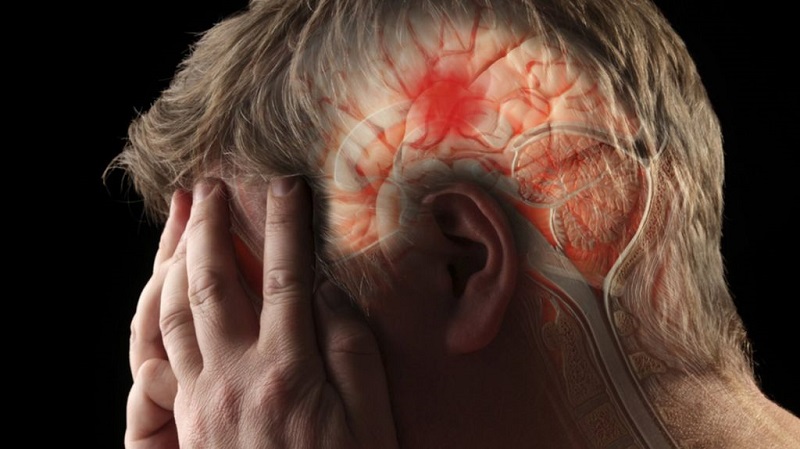 Tai biến mạch máu não có thể để lại biến chứng nghiêm trọng với bệnh nhân