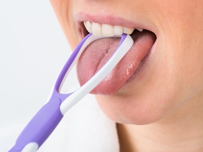 Cần vệ sinh răng miệng và lưỡi sạch sẽ để tránh vi khuẩn xâm nhập vào vết nhiệt