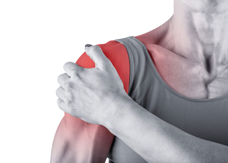 Tổn thương gân cơ chóp xoay là nguyên nhân gây đau vai mạn tính