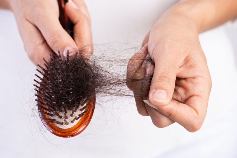 Tình trạng rụng tóc xuất hiện ở một số bệnh nhân F0 sau khi điều trị khỏi 
