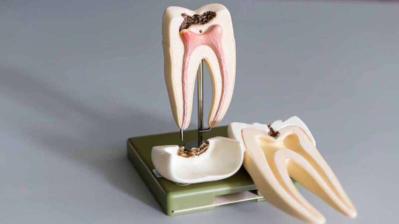 Tủy răng nằm sâu trong lớp ngà răng và men răng