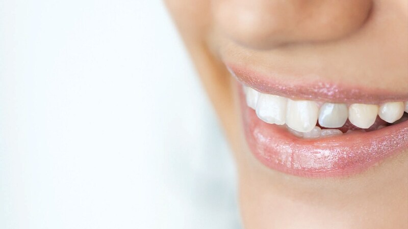 Sau lấy tủy răng, răng yếu và dễ sứt mẻ hơn