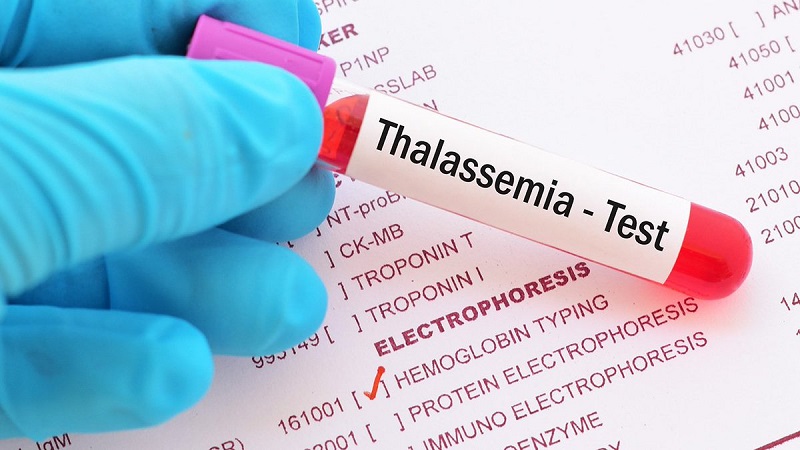 Thalassemia có thể gây ra thiếu máu nhược sắc