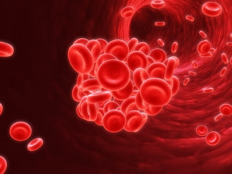 Độ nhớt máu bất thường có thể gây biến chứng huyết khối