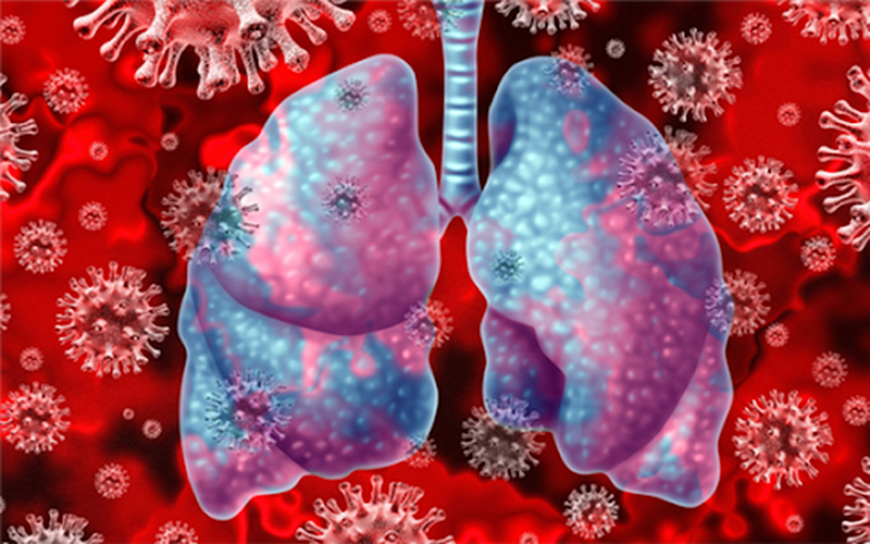 Cytokine phá hủy phổi nghiêm trọng, khiến người bệnh bị suy hô hấp