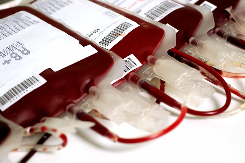 Tùy tình trạng mất máu mà bệnh nhân được truyền lượng hồng cầu lắng khác nhau