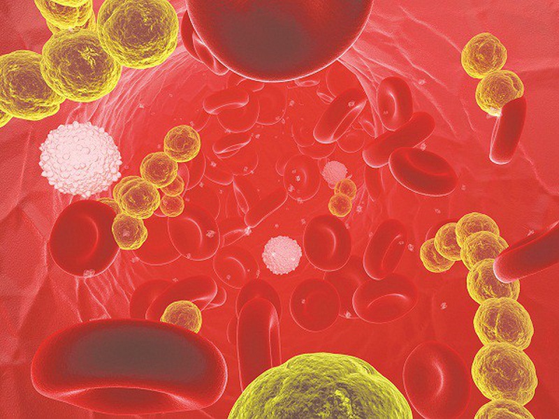 Nhiễm trùng máu xuất phát từ sự tấn công của vi trùng và phản ứng miễn dịch của cơ thể