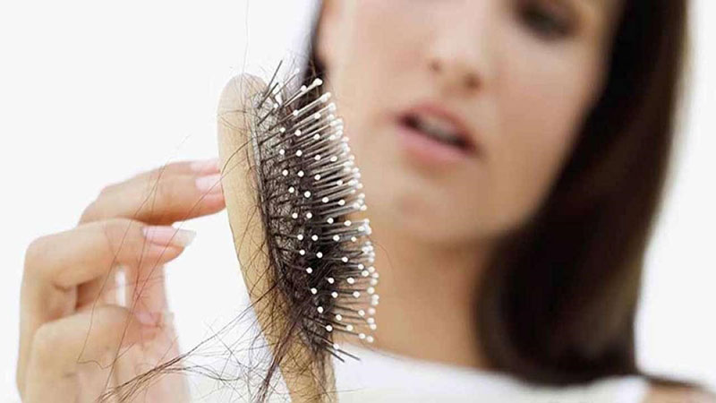 Rụng tóc là dấu hiệu thường gặp của hội chứng hậu Covid - 19