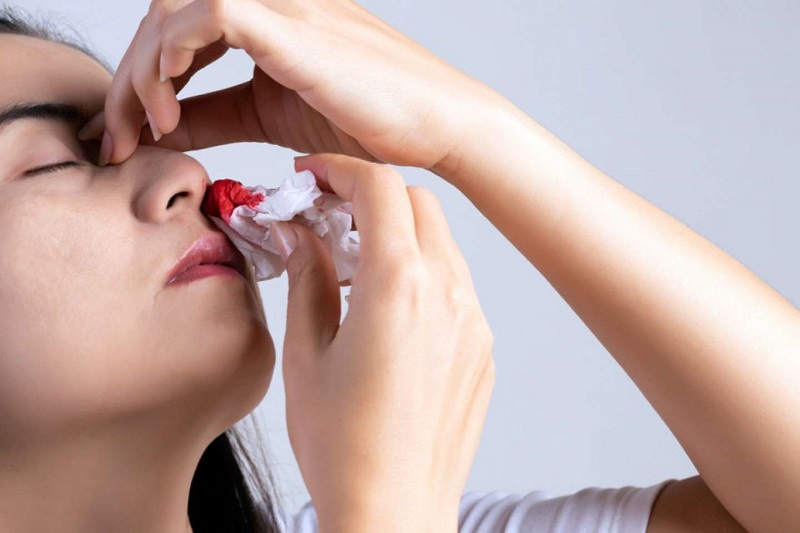 Giảm tiểu cầu có thể khiến chảy máu mũi bất thường